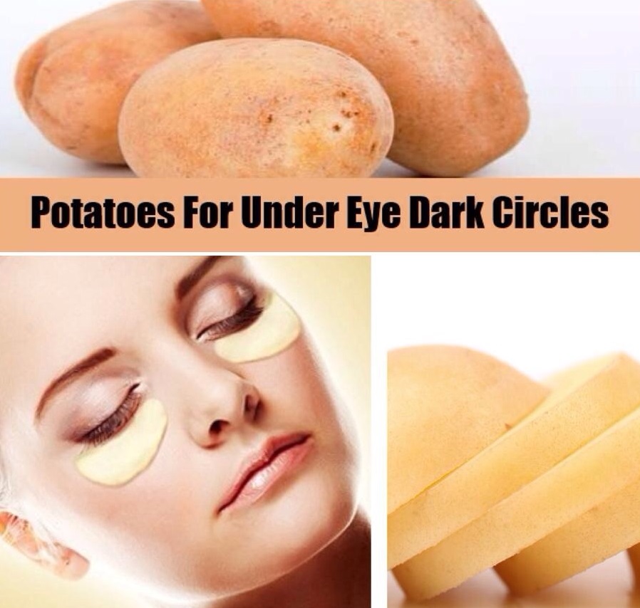 Remove dark circles with potato slices